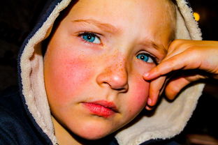 如何瘦脸瘦双下巴的方法图解