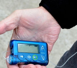 配套工具设备管理百度长尾关键词有哪些 配套工具设备管理百度长尾关键词有哪些