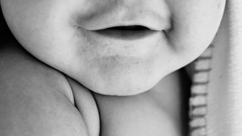 儿童斜视矫正工具图片百度长尾关键词有哪些